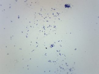 Mikroskoppreparat, Streptokocker