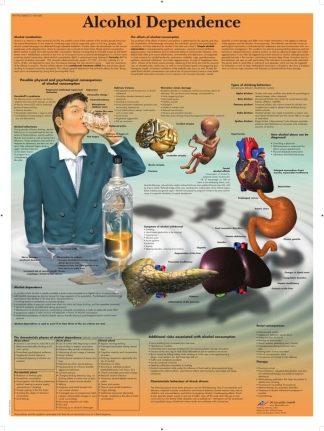 Affisch laminerad - Alkohol